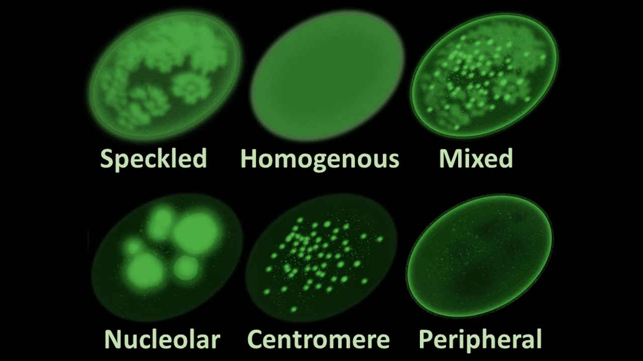 ANA Testing Methodologies: Comparing Indirect Immunofluorescence (IFA) vs. Multiplex Bead Assays