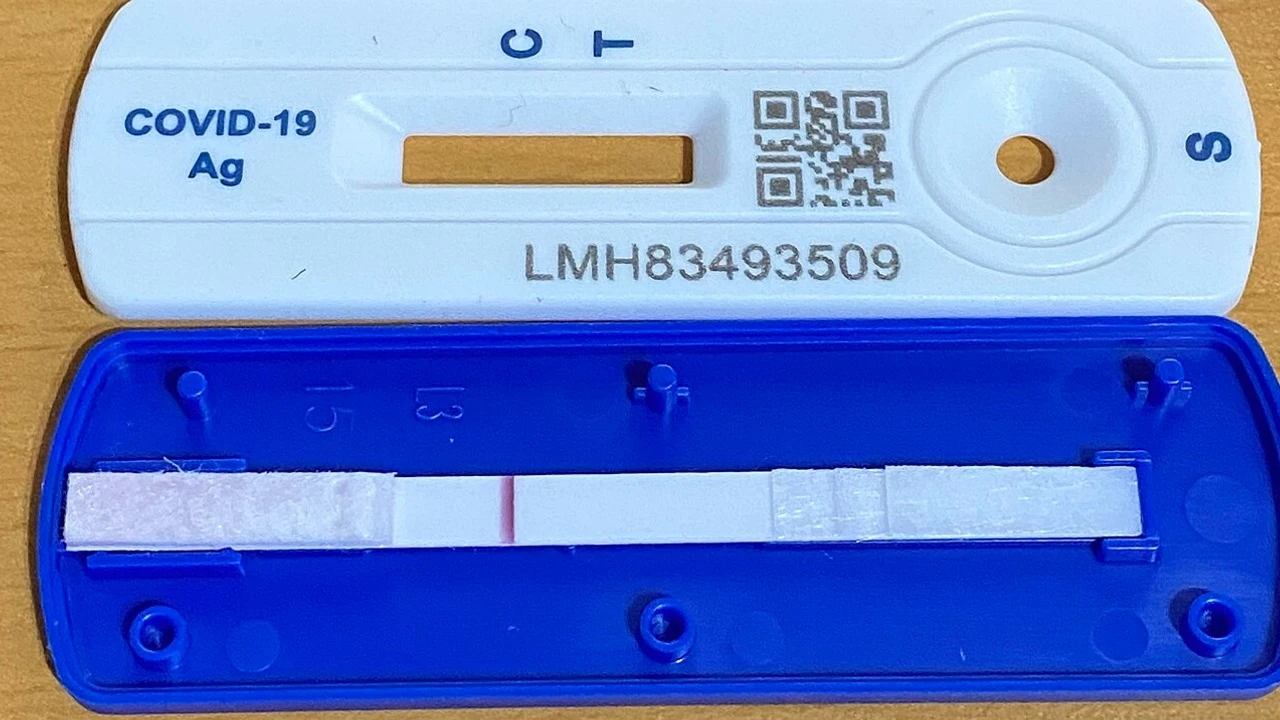 How Diagnostics Companies Evaluate and Select a CDMO for Rapid Test Assembly